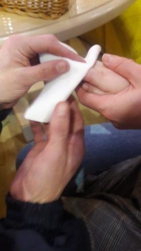 В Альметьевске спасатели освободили застрявший в игрушке палец ребенка1