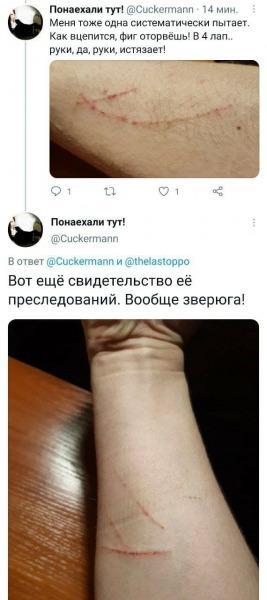 В соцсетях высмеяли твиты ростовской сторонницы Навального о дубинке и засечках на руке1