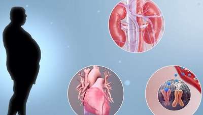 Лечение метаболических заболеваний в клинике Medbalanc
