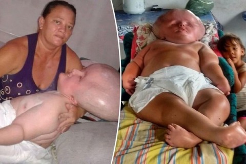 Фото с «гигантским младенцем» напугали Интернет, но правда оказалась куда более жестокой 3