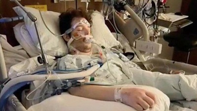 Молодой Парень перенес операцию по полной пересадке лёгких после вейпинга