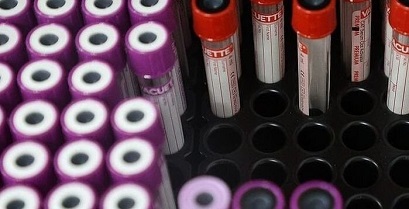 Контрабанда яйцеклеток: Задержано на Российско-Грузинской Границе