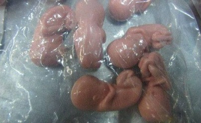 Сотни эмбрионов обнаружены в сумке женщины из Эстонии