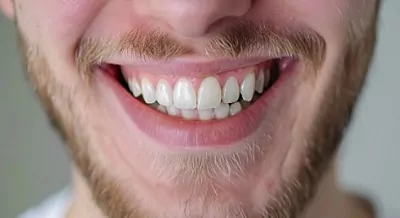 Как исправить прикус у взрослого человека: методы и особенности коррекции