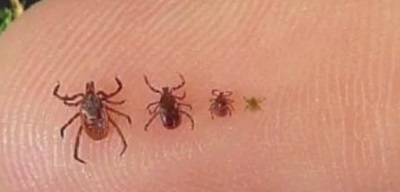 Клещевой энцефалит: эффективные методы лечения и предупреждение осложнений