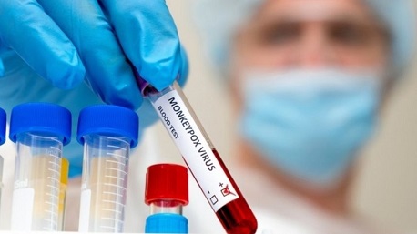 Испания: лидирующая страна по числу случаев оспы обезьян в Европе