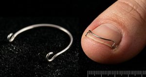 Скобы и пластины для коррекции ногтя: честное сравнение